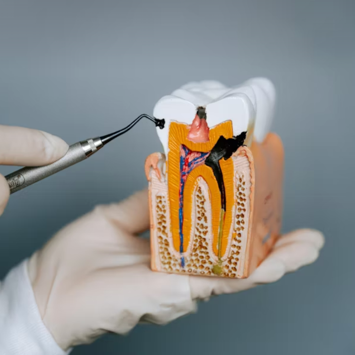 Endodontie