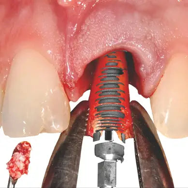 Implantologie & chirurgie