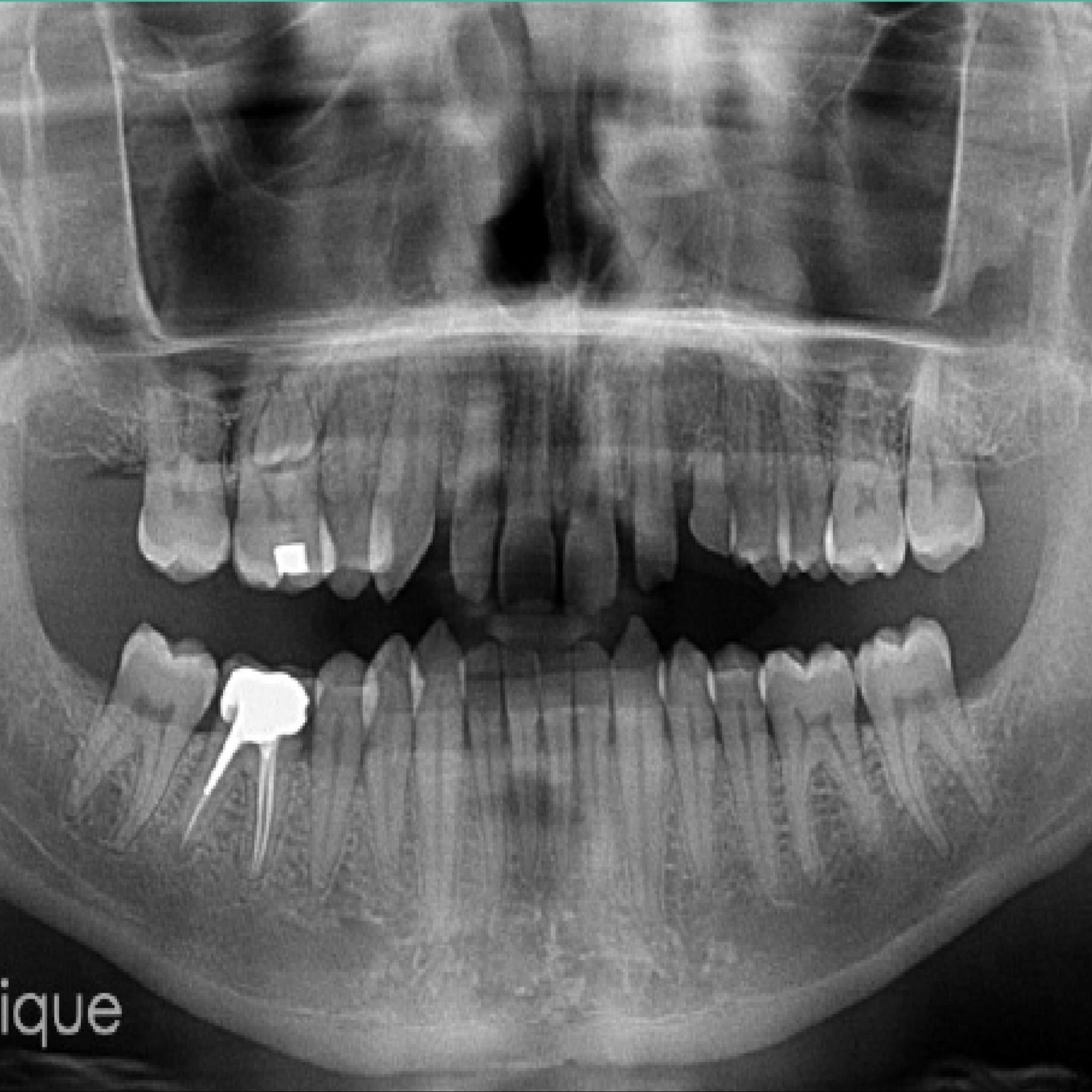 Cone Beam CBCT
