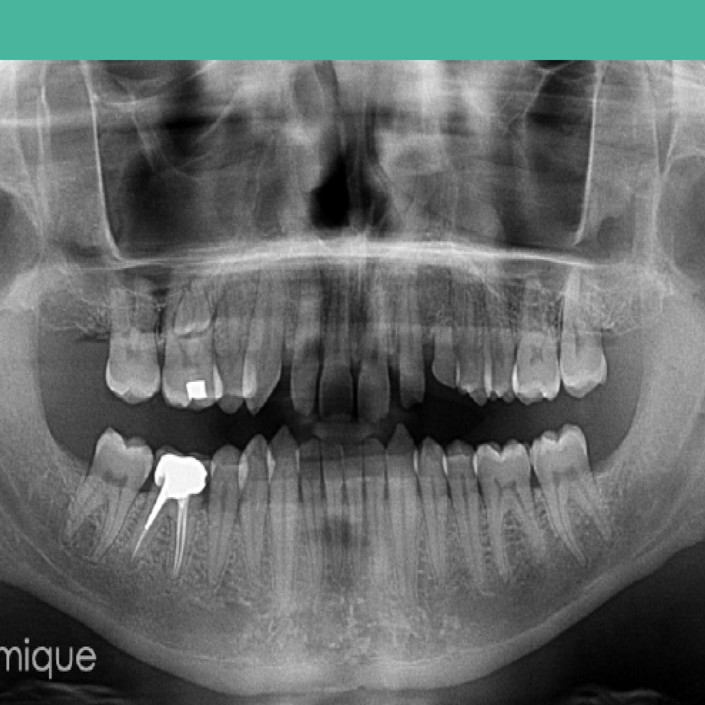 Cone Beam CBCT