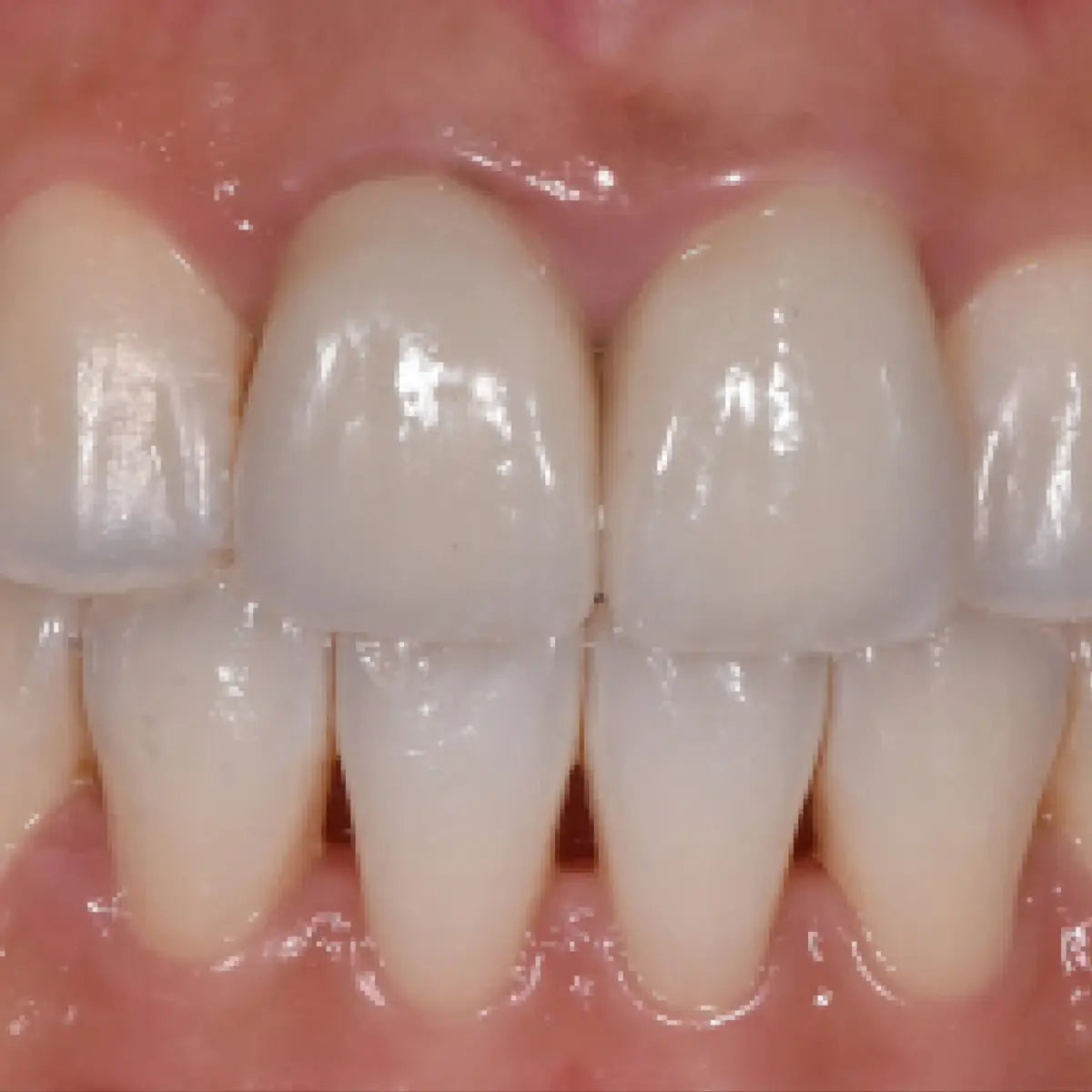 Formation Chirurgie Pré-Prothétique - Clinicall