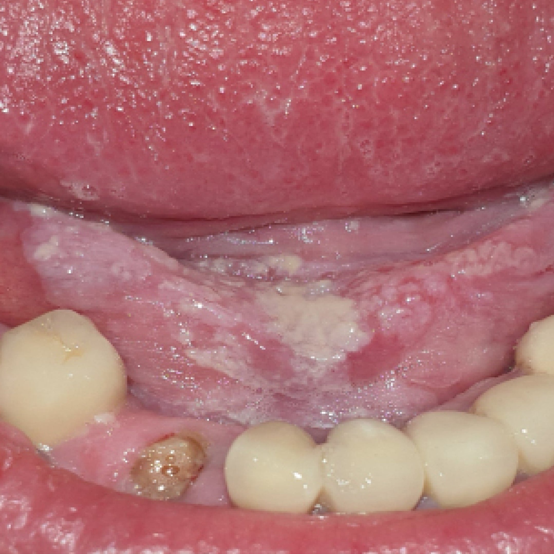 Dermatologie buccale