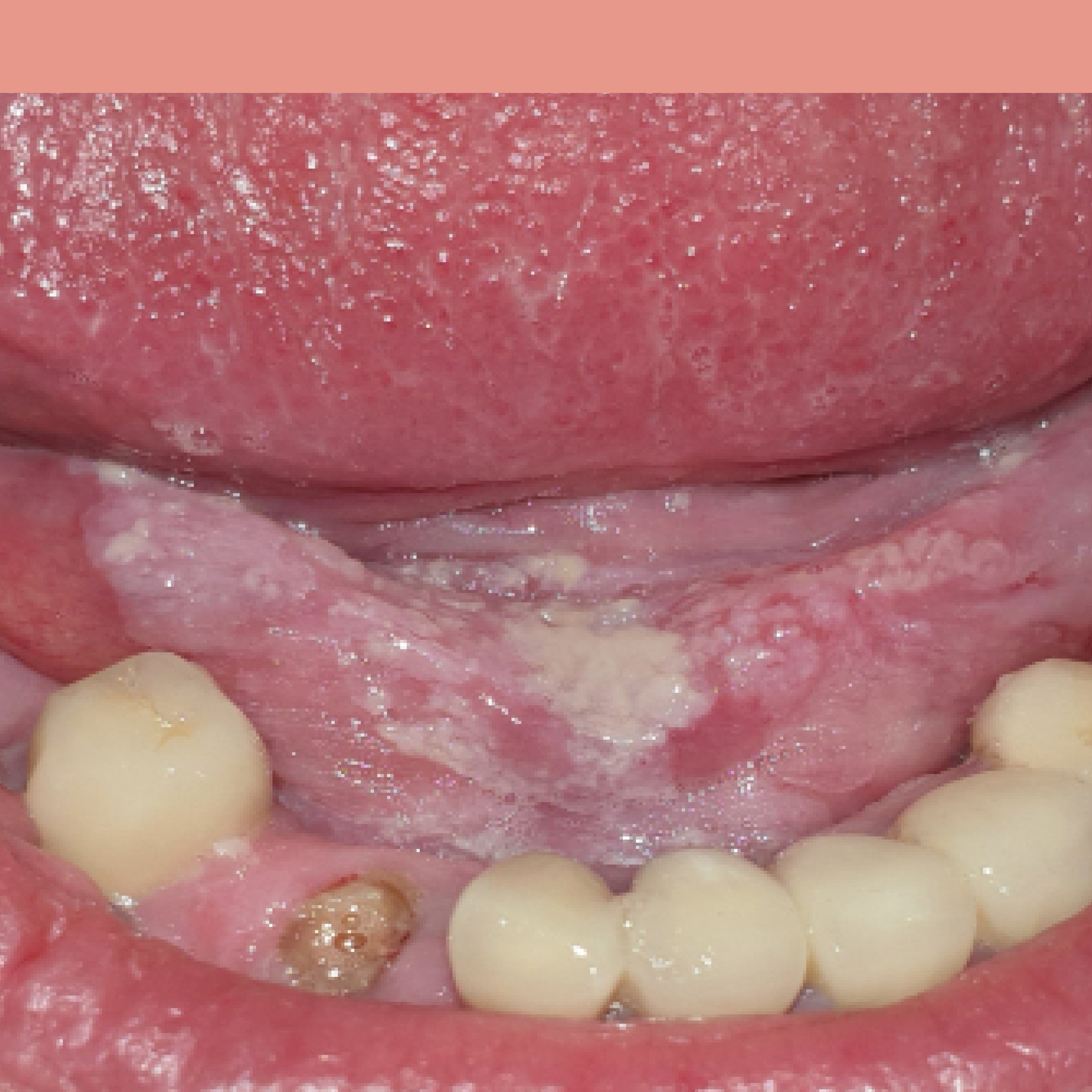 Dermatologie buccale