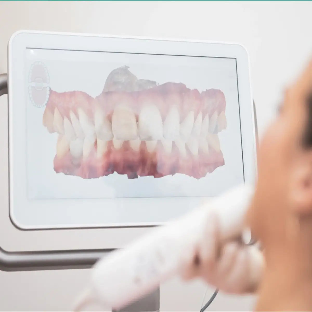 Formation Empreinte Optique - Clinicall