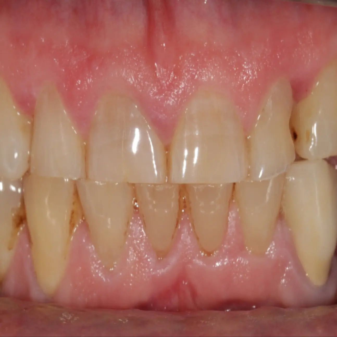 Formation Plan de Traitement occlusodontie - Clinicall