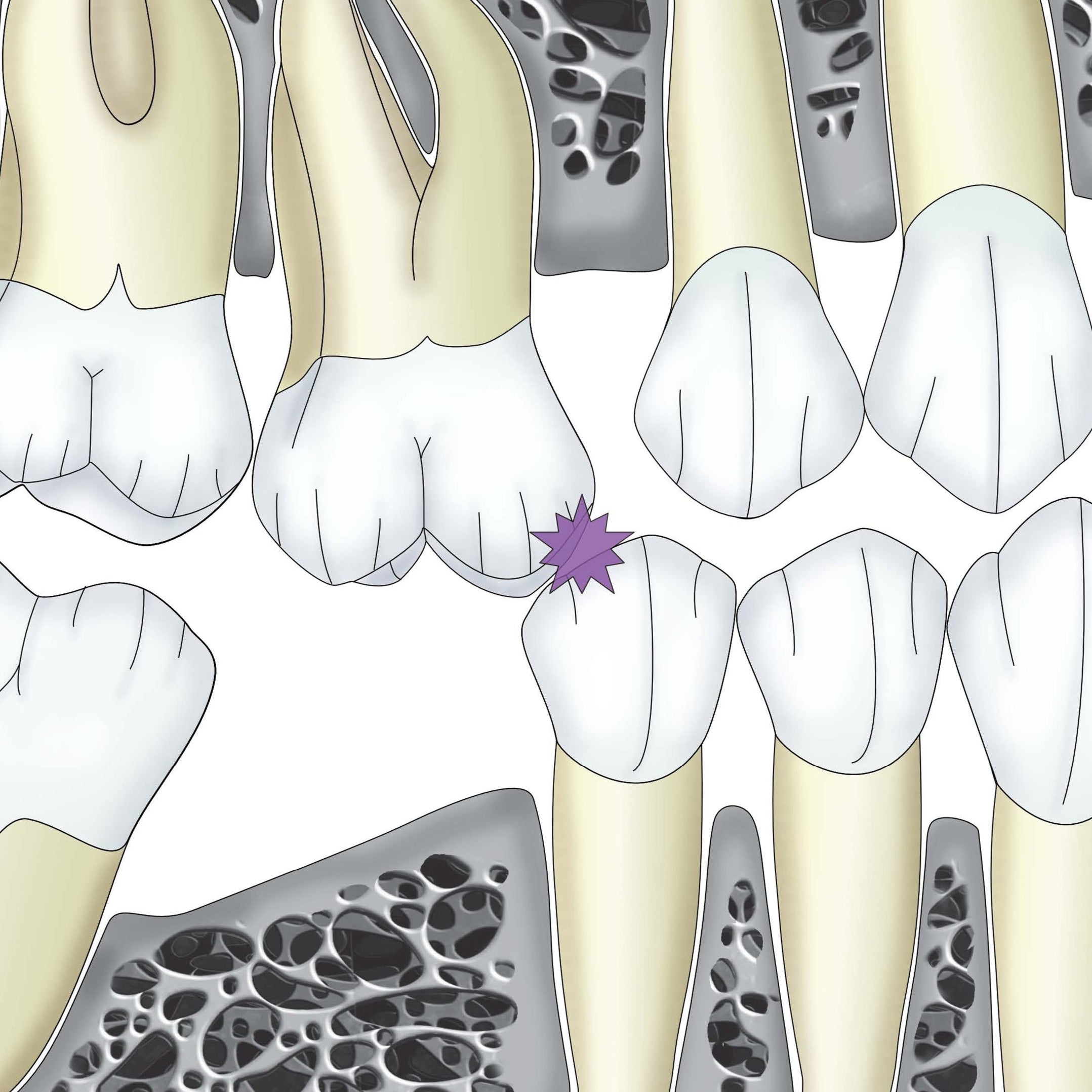 Occlusodontie