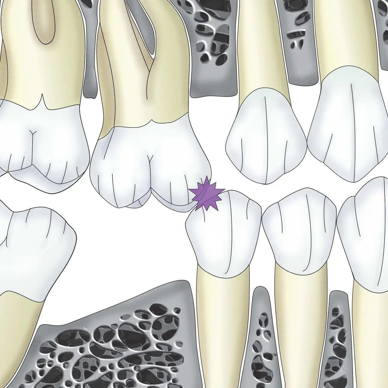 Formation Occlusodontie - Clinicall