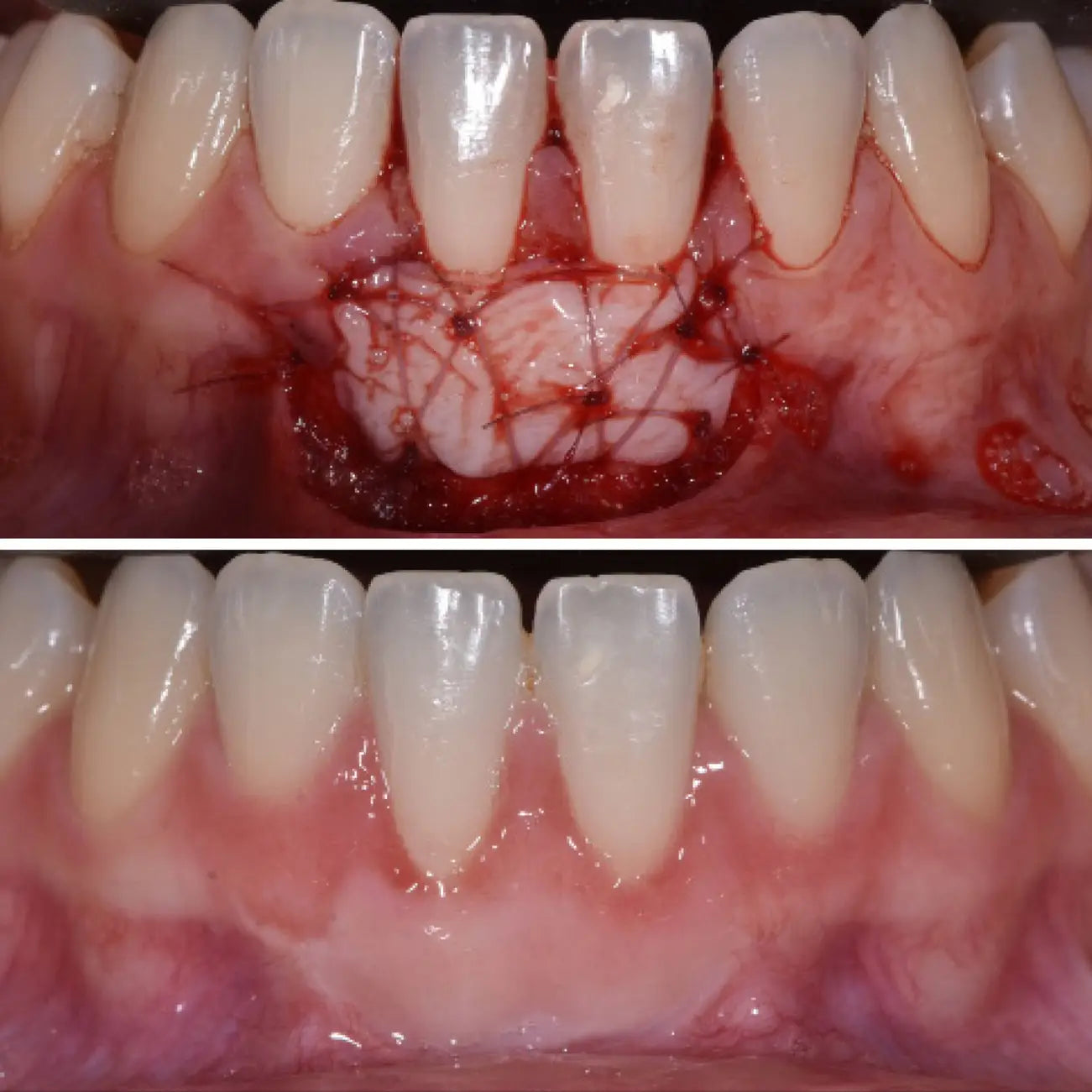 Formation Parodontologie - Clinicall